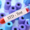 Does Urgent Care Clinics Do STD Testing?