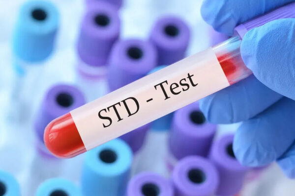 Does Urgent Care Clinics Do STD Testing?